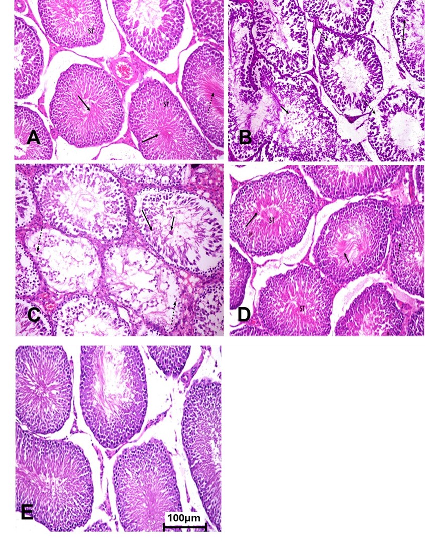 Figure 1. Histological changes in testicular tissue of control, fluoxetine-administered, Ashwagandha-treated, and combined treatment groups in adult male rats