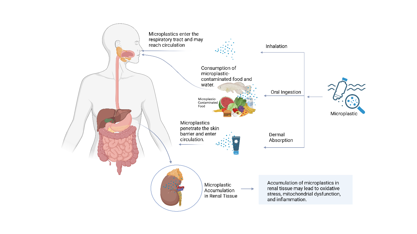 Figure 1. Major routes of MP exposure and renal accumulation. MPs enter via ingestion, inhalation, and dermal contact, translocate into the systemic circulation, and accumulate in renal tissue, where they can induce oxidative stress, mitochondrial dysfunction, inflammation, and barrier instability [20,39].