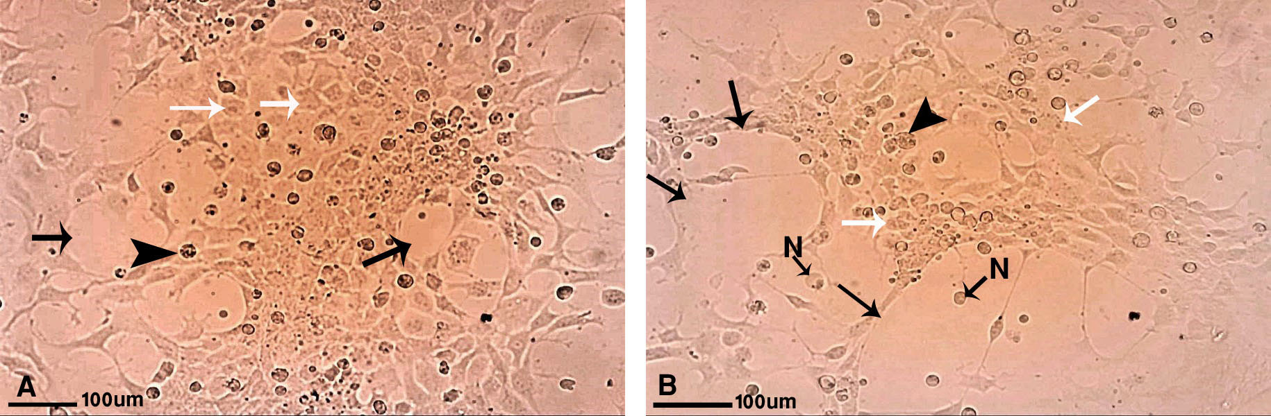 Figure 2. Morphology of cultured liver cells from Acanthopagrus arabicus treated with higher concentrations of DEX (3×102 and 3×103 µg/ml); Swollen cells (black arrows), round cells (white arrows), plucked cells (black arrowheads); N: nucleus.