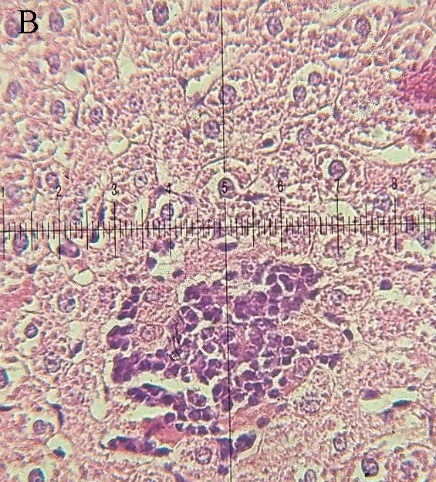 Figure 5. Representative hepatic histology of experimental rat groups. (A) Normal control group displaying intact hepatic cords and uniform hepatocyte morphology. (B) Streptozotocin‑induced diabetic group showing marked structural disorganization, hepatocellular necrosis, vascular congestion, and dense aggregation of inflammatory cells around the central vein. (C) Extract‑treated diabetic group exhibiting evident hepatocyte regeneration and restoration of hepatic architecture with minimal tissue injury (H&E staining, ×200).